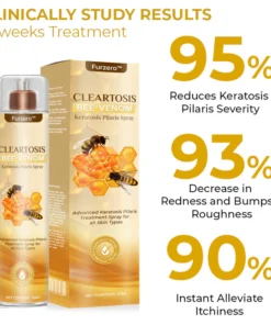 Furzero™ Cleartosis Bee Venom Keratosis Pilaris Spray