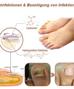 Liacsy™ AdvanceLight FootFix Device