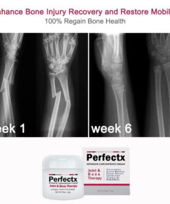 CroAie™ Perfeᴄtx Joint & Bone Therapy Cream