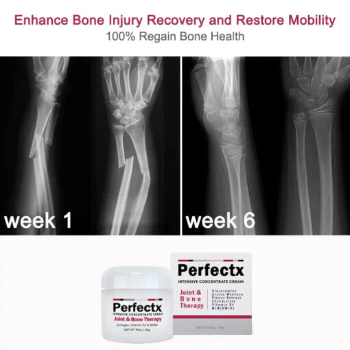 CroAie™ Perfeᴄtx Joint & Bone Therapy Cream