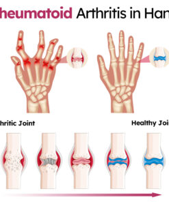 CroAie™ Perfeᴄtx Joint & Bone Therapy Cream