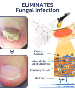 GFOUK™ Comfrey Healing 7 Days Growth And Strengthened Nail Serum