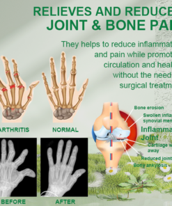 Lotmay™ Bee Venom Joint Pain & Bone Healing Spray